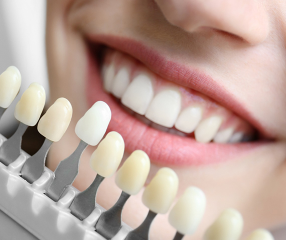 Patient comparing the color of your smile to a shade guide.