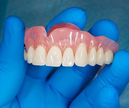Dentist carefully holding denture with thinned base